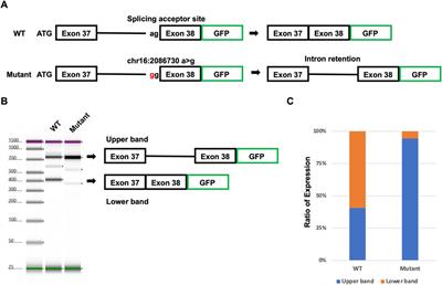 Target-capture full-length double-stranded cDNA long-read sequencing through Nanopore revealed novel intron retention in patient with tuberous sclerosis complex